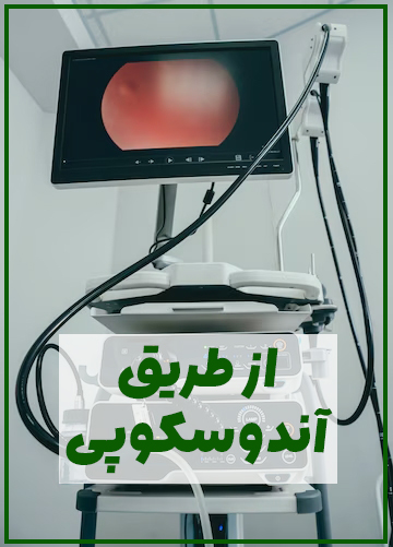 بوتاکس معده