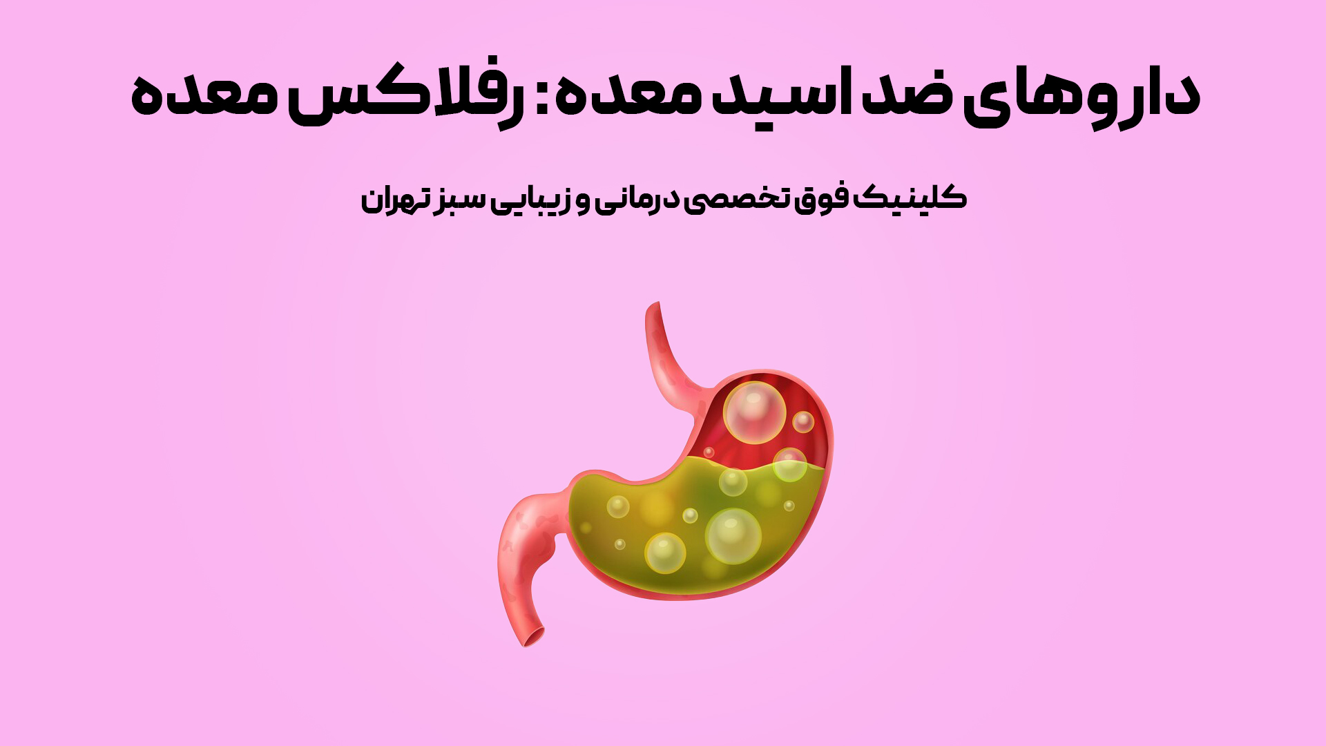 داروهای ضد اسید معده: رفلاکس معده