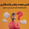 ماندگاری بوتاکس معده چقدر است؟6حقیقت علمی